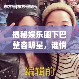 揭秘娛樂圈下巴整容明星，誰悄悄整過下巴？