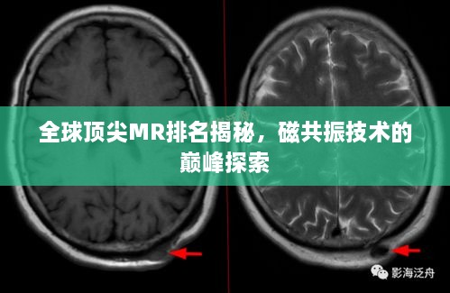 全球頂尖MR排名揭秘，磁共振技術的巔峰探索