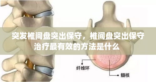 突發(fā)椎間盤突出保守，椎間盤突出保守治療最有效的方法是什么 