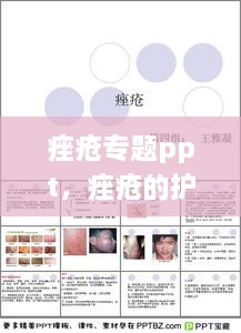 痤瘡專題ppt，痤瘡的護(hù)理ppt 