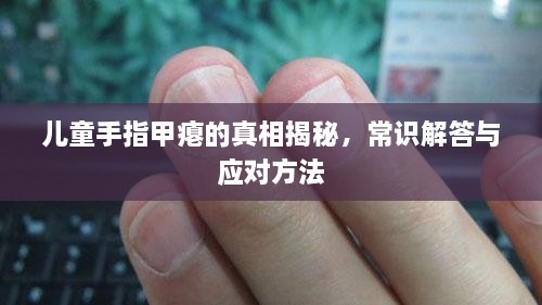 兒童手指甲癟的真相揭秘，常識解答與應(yīng)對方法