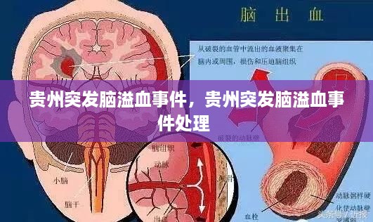 貴州突發(fā)腦溢血事件，貴州突發(fā)腦溢血事件處理 